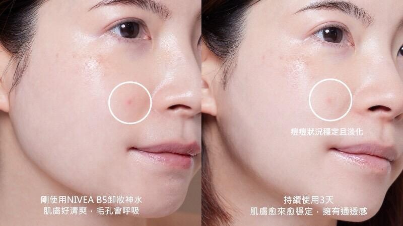 网友热推新宠儿#妮维雅B5卸妆神水！M编实测只要，卸净毛孔零残妆，肌肤深呼吸超健康，净肤