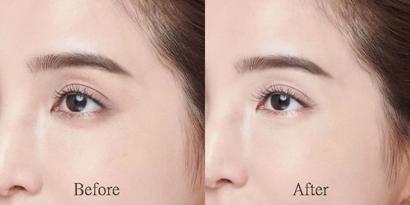 有效改善黑眼圈、眼周暗沈細紋和細疏睫毛