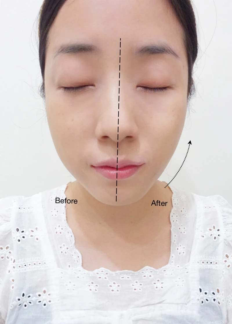 M編實際以小花托腮按摩法測試一邊臉後,臉部線條明顯往上提升,緊實拉提的傳說是真的啊!!! M編實際以小花托腮按摩法測試一邊臉後,臉部線條明顯往上提升,緊實拉提的傳說是真的啊!!!