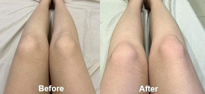 Melano CC使用三週後的差異