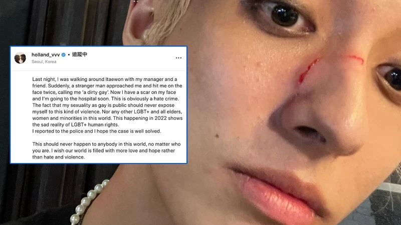 韓國同志歌手Holland自曝被毆打及語言羞辱 韓國同志歌手Holland自曝被毆打及語言羞辱