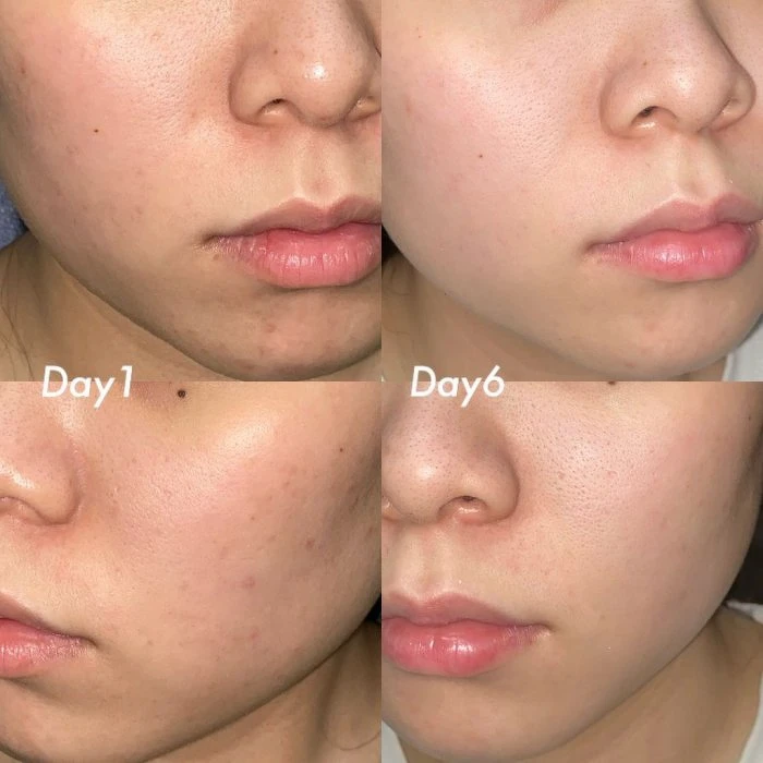 圖片提供Dcard_雞腿小公主 圖片提供Dcard_雞腿小公主