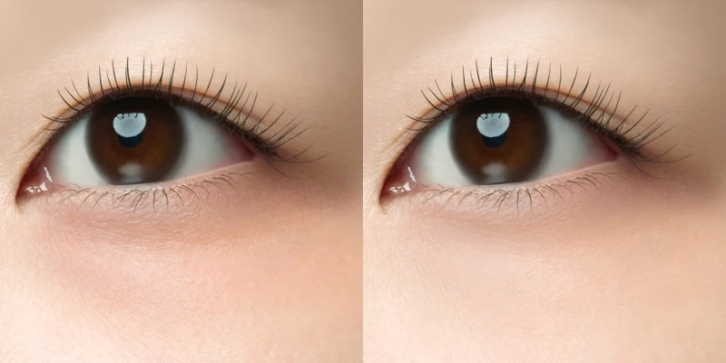 Visée幻飾眼圈遮瑕霜(左)使用前、(右)使用後。