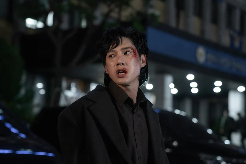 《黑暗榮耀2》全宰寯滿臉是傷 《黑暗榮耀2》全宰寯滿臉是傷