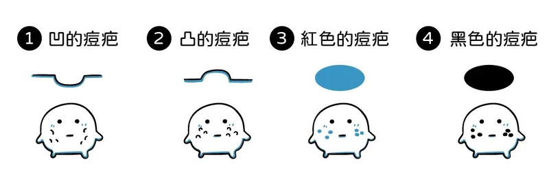 Photo/《光澤美肌保養術》王朝輝醫師著。 Photo/《光澤美肌保養術》王朝輝醫師著。