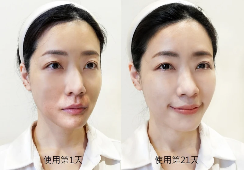 實際使用小紅水前後的差異