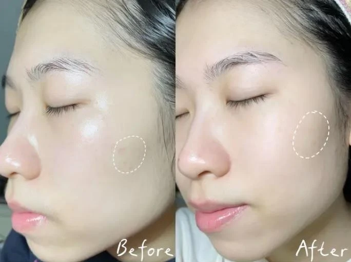 圖片來源:Dcard@Anita 圖片來源:Dcard@Anita