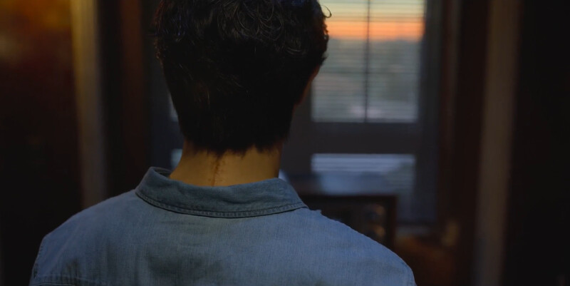 浩載的頸項上長長疤痕代表什麼？