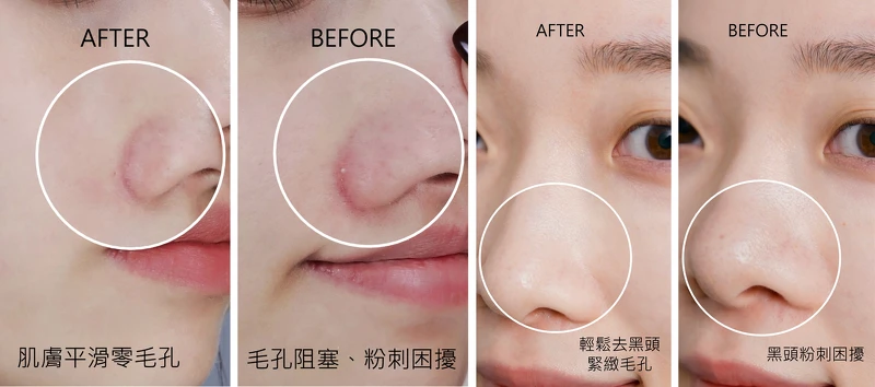 網友實測「黑米精萃潔顏油」卸妝,有效去除黑頭、收縮毛孔,肌膚重現光滑無瑕 網友實測「黑米精萃潔顏油」卸妝,有效去除黑頭、收縮毛孔,肌膚重現光滑無瑕