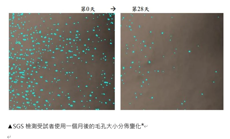 *此實驗數據來自SGS實測20名受試者,每天早晚使用一次茶樹三酸毛孔安瓶精華,使用14天/28天後實測結果。 *此實驗數據來自SGS實測20名受試者,每天早晚使用一次茶樹三酸毛孔安瓶精華,使用14天/28天後實測結果。