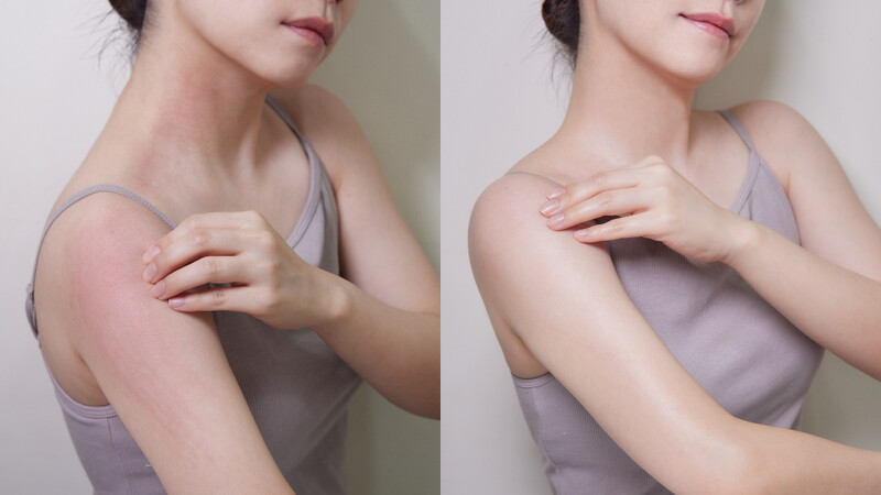 左 : 未使用前乾癢、紅癢、搔抓,右 : 使用後鎮定舒緩 左 : 未使用前乾癢、紅癢、搔抓,右 : 使用後鎮定舒緩