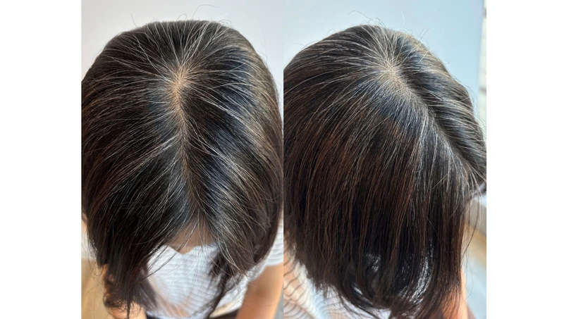 未使用前,整頭佈滿白髮髮絲。 未使用前,整頭佈滿白髮髮絲。