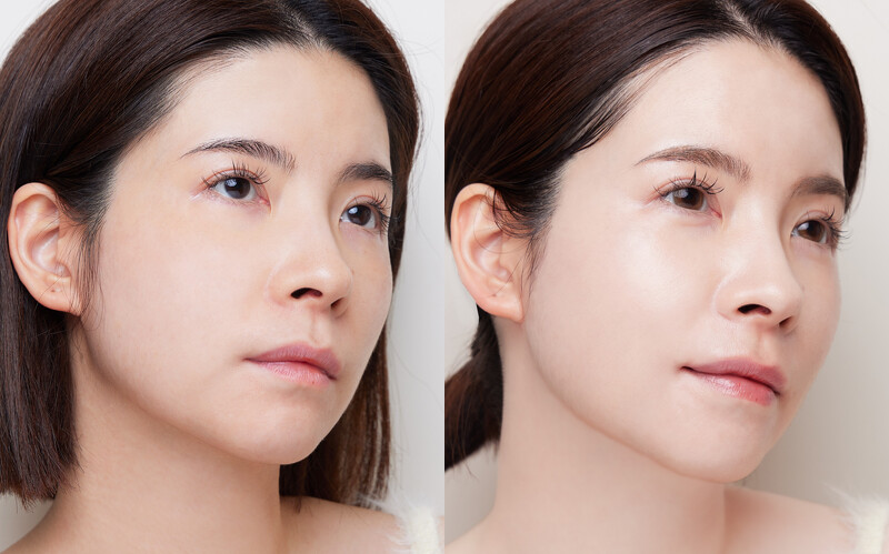 左 : 使用前肌膚暗沉，右 : 使用後肌膚透亮平滑