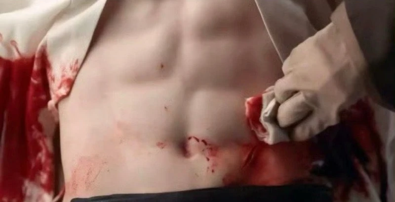 肖戰的不對稱腹肌引發討論。