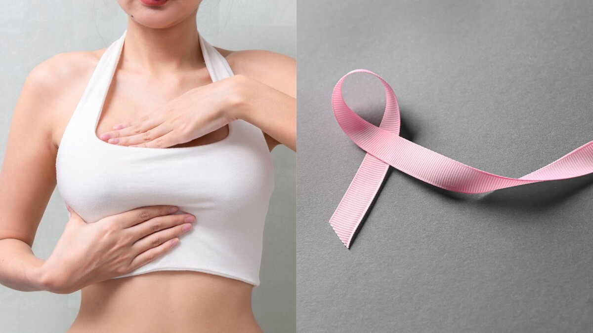 乳頭出血別輕忽!可能是乳頭內長腫瘤,乳癌風險增5倍