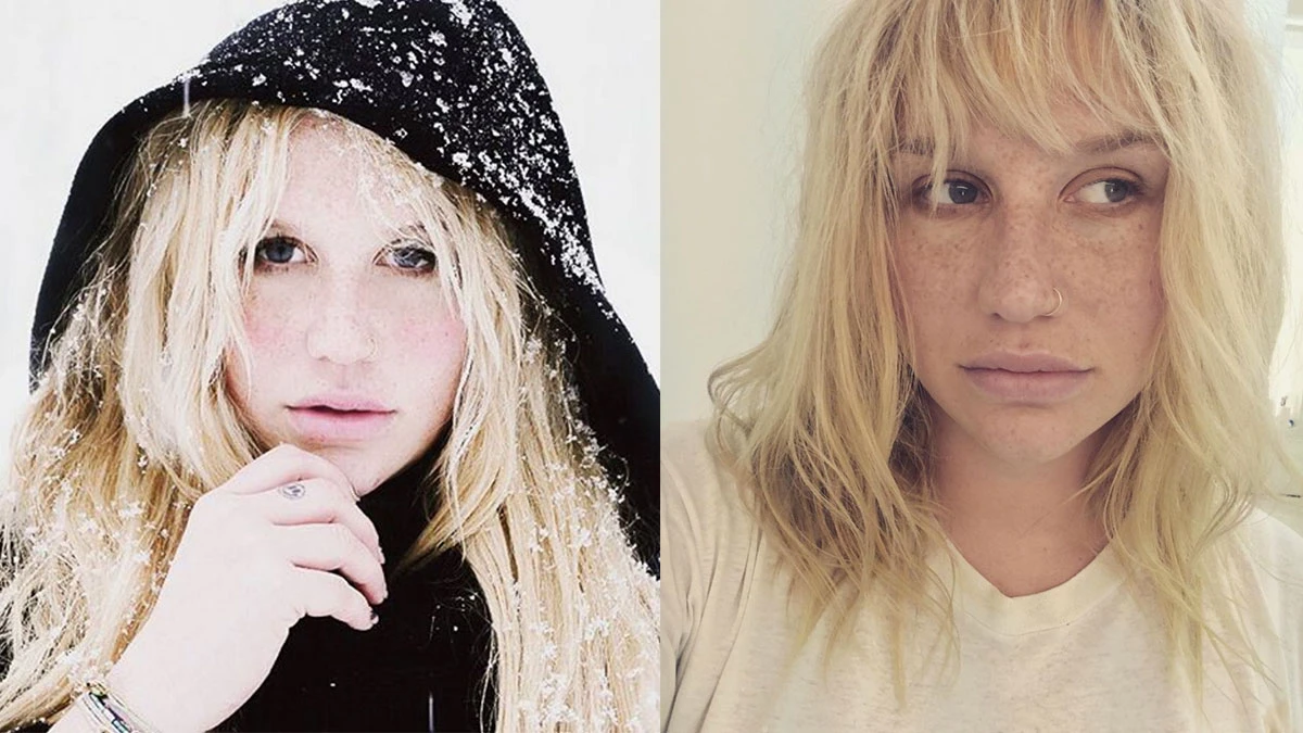 陷入官司纏訟!悪女凱莎(Kesha)心碎痛哭:「當投注心力的一切都被奪走。」