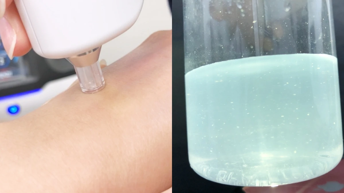 夏天詢問度最高的醫美就是「水飛梭」,大家最想知道的QA一次解答