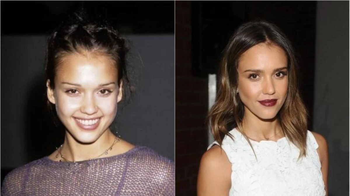 什麼！連她也有整型嗎？ 15個出乎意料有整型的好萊塢大明星是…