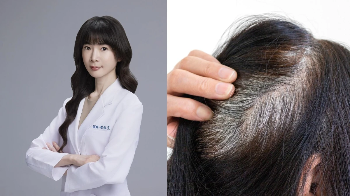 白髮是妳的心頭大患?一想到要補染,花錢花時間又擔心健康?專業醫師建議其實超簡單,想要更年輕都學起來!