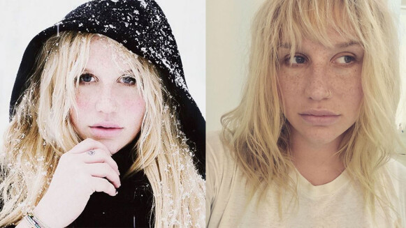 陷入官司纏訟!悪女凱莎(Kesha)心碎痛哭:「當投注心力的一切都被奪走。」