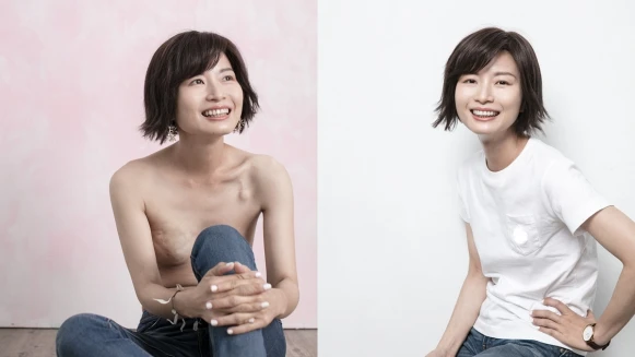 疤痕是人生的風景！邱毓婷，「老天爺要我更靠近自己，才給我功課練習。」