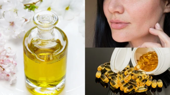 冬天皮膚乾裂，不止缺水更缺「油」！告訴你精華油保養正確觀念