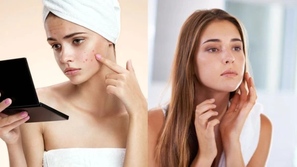 敏弱肌保養對策，避免成為長期發炎肌，讓肌膚變得更敏感的3大NG行為務必小心！