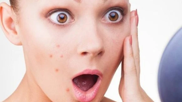 惱人冬季癢、蕁麻疹、青春痘......風寒、虛寒易引發皮膚病，3招養出好膚況！