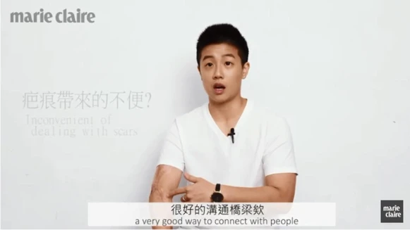 疤痕讓我獨一無二！周旻琦，「活到30歲，終於開始喜歡我的身體。」Behind The Scars-Mickey Chou