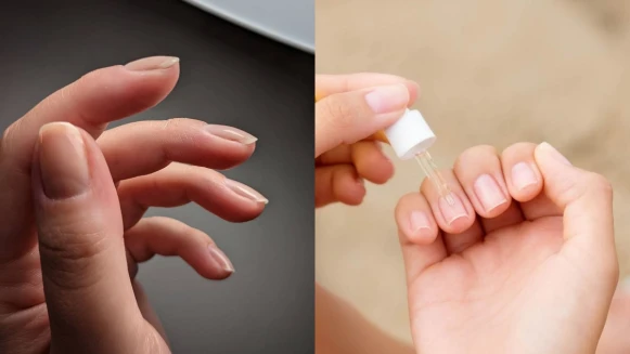 想要指甲漂亮,只擦護手霜還不夠!2步驟精華保養揮別指緣脫皮與肉刺