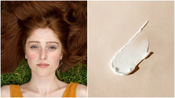 肌膚發紅、長膿皰，我是酒糟肌還是痘痘肌？酒糟該如何保養？