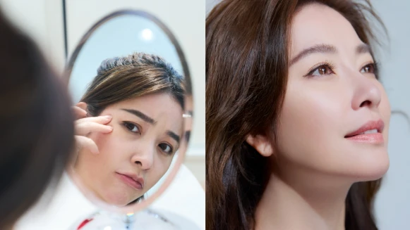 擺脫眼袋、淚溝、黑眼圈!幸福女人許維恩眼底的光…有老公給的愛情、有君綺醫美「無痕三點定位」創造自信電眼!無需動大刀、恢復期短的超強眼袋手術