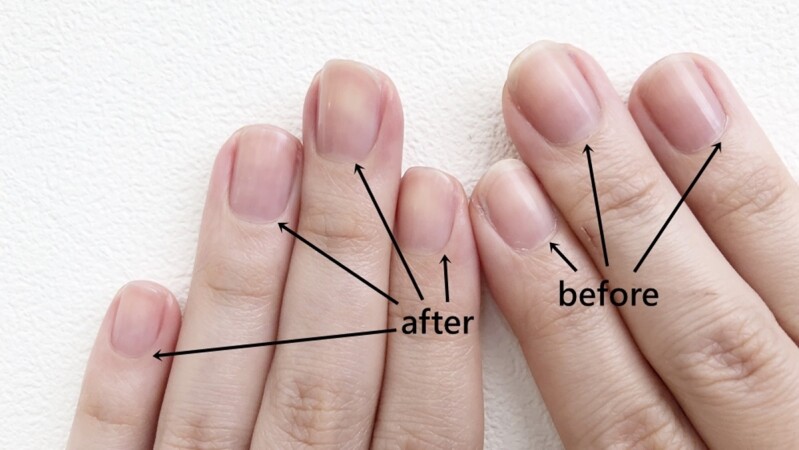 什麼時候剪指甲最好？指甲長度要剪到多長？指緣硬皮怎麼處理？日常「剪指甲」最常遇到的5個問題一次解答