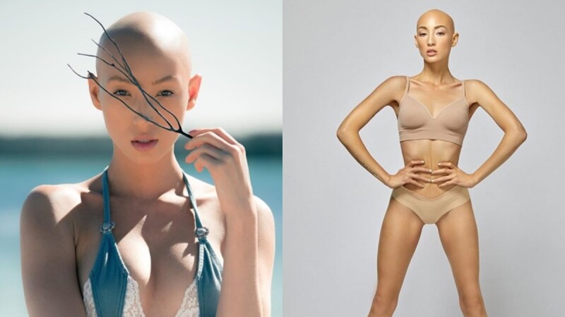 勇敢接受拿下假髮的自己!罹患全頭禿,《超級名模生死鬥》24季女模Jeana Turner:「光頭也能一樣美麗。」