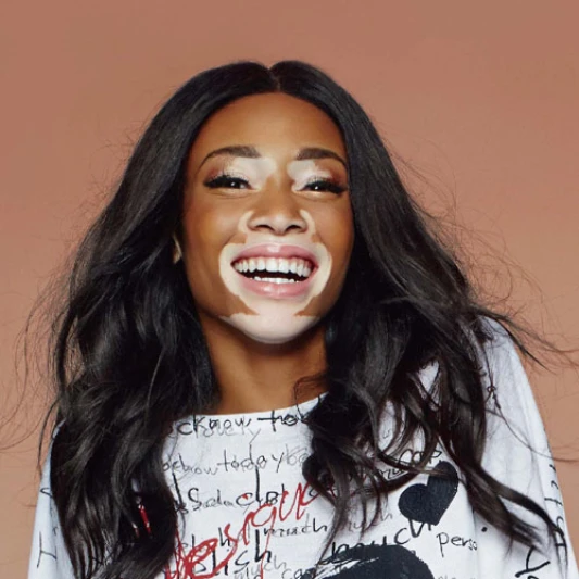 超模生死鬥斑馬女模香緹兒 接下Desigual代言展現自信美