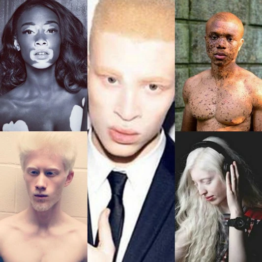 我知道我很美！#InMySkinIWin顛覆世俗美麗標準