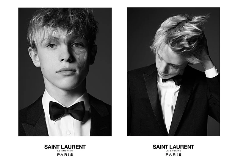 美 ≠ 完美！胎記男孩Judah Lang登上SAINT LAURENT永恆系列新廣告