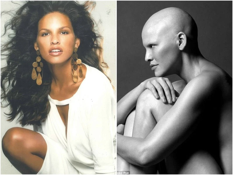 勇敢去愛另一個自己！抗癌女模：「癌症就是這樣，但我卻感覺更加美麗。」