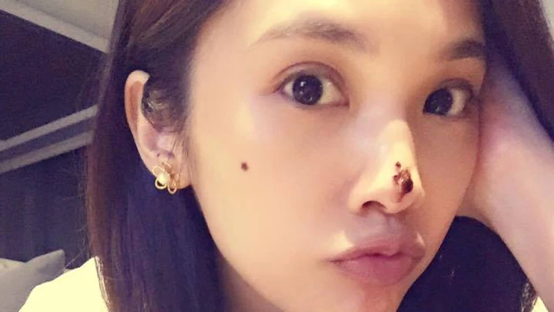 無瑕才是美？那可不見得！3個小技巧讓臉上的雀斑和痣萌到破表！