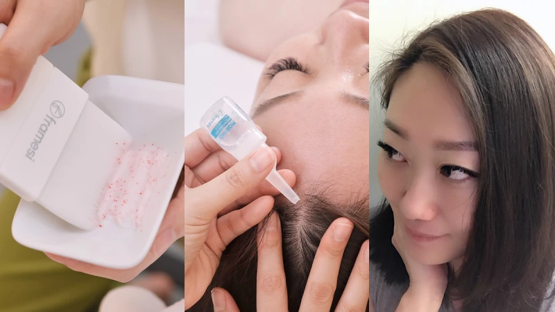 一上班就緊繃、換季又癢又有小白屑、到了夏天還容易出油？難相處的高壓頭皮，M編終於找到方法治了！