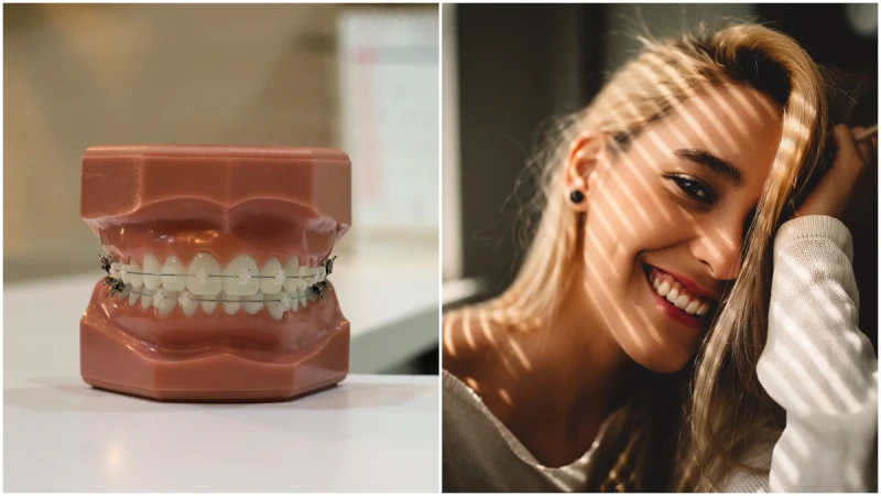 「牙齒矯正」新攻略！5種方式優缺點大解析 必做4招擺脫「歪斜齒」