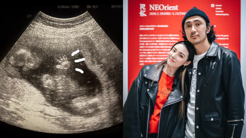 36歲歐陽靖驚喜宣布懷孕5個月!與日本攝影師男友登記結婚,愛情長跑5年修成正果