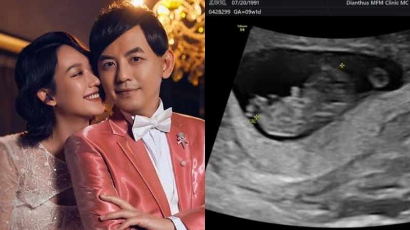 孟耿如懷孕啦!49歲黃子佼升格當爸,曝寶寶超音波照宣布喜訊
