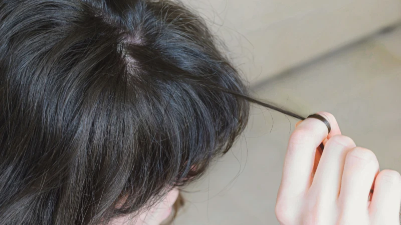 常常有意或無意的拉扯頭髮？有可能患了拔毛症！4個控制情緒技巧+皮膚科醫師髮肌養護秘訣分享！