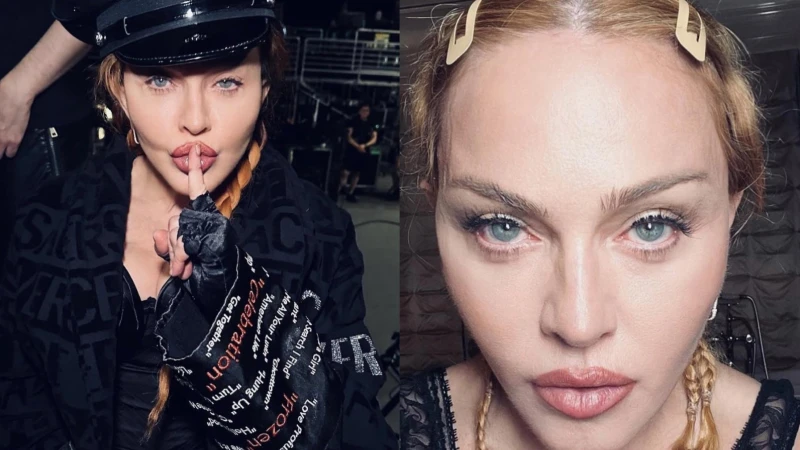 瑪丹娜驚傳失去知覺！出現嚴重細菌感染，緊急送加護病房治療