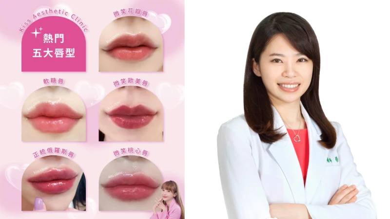 還不知道微笑花瓣唇？千美診所蔡琇如醫師、執行總監Daisy分享回頭率超高的「OBT女神動態玻尿酸 #Kysse」：量身訂製完美唇形，讓你變美變年輕，綻放迷人笑容！